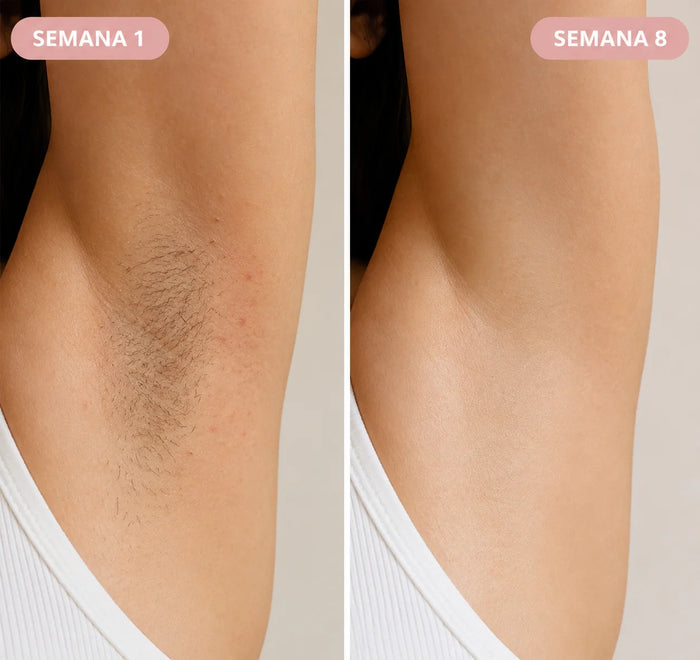 Resultado antes y después LumiSkin