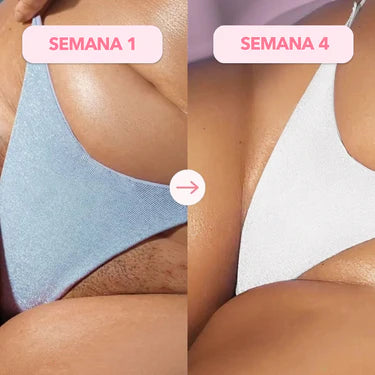 Antes y después LumiSkin 2