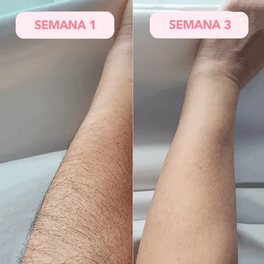 Antes y después LumiSkin 3