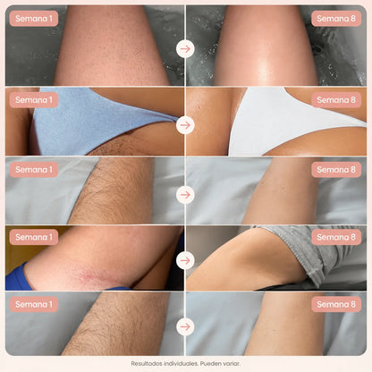 Antes y después en cinco zonas del cuerpo, de la semana 1 a la semana 8 con LumiSkin
